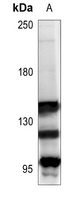 mGLUR1 Rabbit Polyclonal Antibody