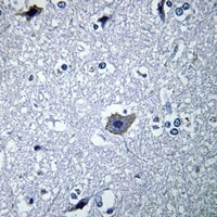 mGLUR1 Rabbit Polyclonal Antibody