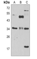 MRP Rabbit Polyclonal Antibody