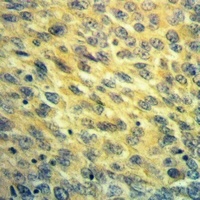 Anti-NDUFB7 Antibody