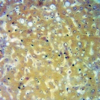 Anti-Orosomucoid 1 Antibody