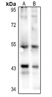 p53 (Acetyl-K386) Antibody