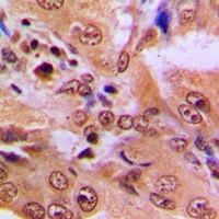 p53 (Acetyl-K386) Antibody