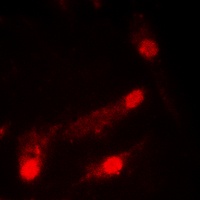 p53 (Acetyl-K386) Antibody