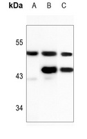 PICK1 Antibody