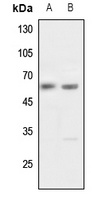 Pokemon Rabbit Polyclonal Antibody
