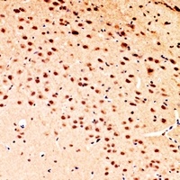Anti-POLR3G Antibody