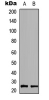 RAB39B Antibody