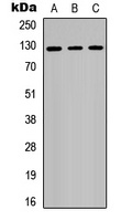 RB2 Rabbit Polyclonal Antibody