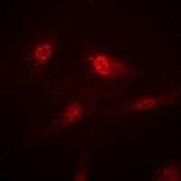 RB2 Rabbit Polyclonal Antibody