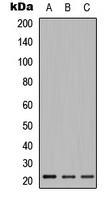 Relaxin 2 Rabbit Polyclonal Antibody