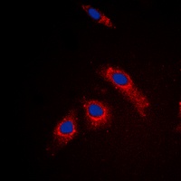 Anti-RPL3L Antibody