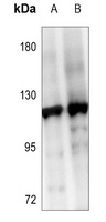 SENP6 Rabbit Polyclonal Antibody