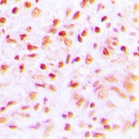 SENP6 Rabbit Polyclonal Antibody