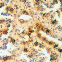 Anti-SFTPA1 Antibody