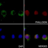 Anti-TBK1 Antibody