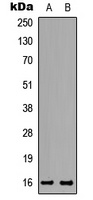 TNP2 Antibody