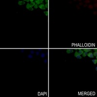 YKL-40 Antibody