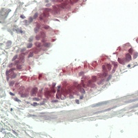 ZNF496 antibody
