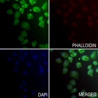 Anti-ZNF496 Antibody