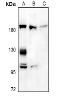 A2M Antibody