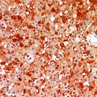 A2M Antibody