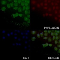 Anti-ABHD4 Antibody