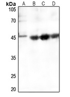 Smooth Muscle Actin Antibody