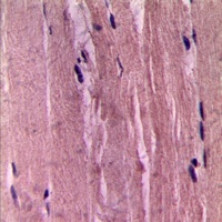Smooth Muscle Actin Antibody