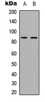 ADAM28 Rabbit Polyclonal Antibody