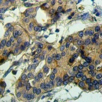 Anti-ADAMTS10 Antibody