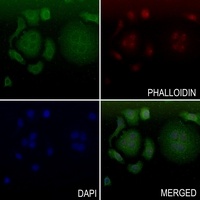 Anti-ADAMTS10 Antibody