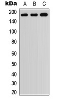 ADAMTS7 Rabbit Polyclonal Antibody