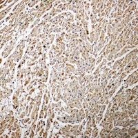 Anti-ADAMTS7 Antibody