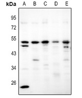 Adenosine A2b Receptor Rabbit Polyclonal Antibody