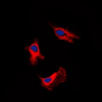 Adenosine A2b Receptor antibody