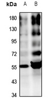 Alpha-2A Adrenergic Receptor Rabbit Polyclonal Antibody