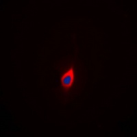 Anti-AKAP3 Antibody