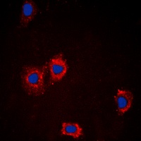 AKT Antibody