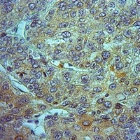 Anti-ALDH1A1 Antibody