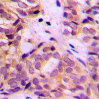 Anti-ALDH1A2 Antibody