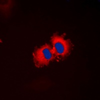 Anti-ALDH1A2 Antibody