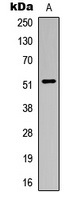 ALDH3B1 Antibody