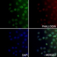 Anti-ALDOC Antibody