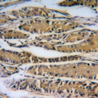 Anti-ALP Antibody