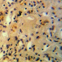 Anti-AMPD2 Antibody