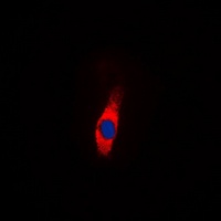 Anti-AMPD2 Antibody