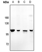 Amphiphysin 1 Rabbit Polyclonal Antibody