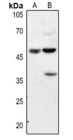 Annexin A7 Antibody