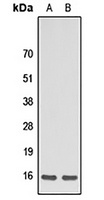Apelin Rabbit Polyclonal Antibody